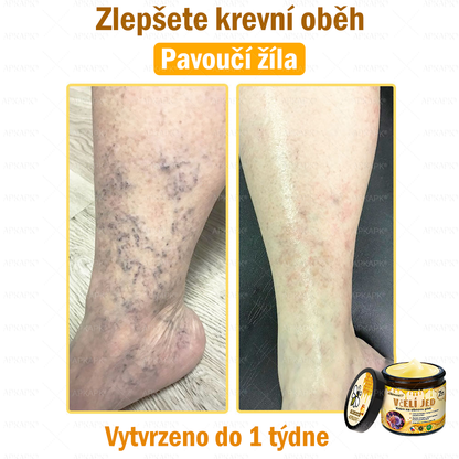 🐝Dermatologicky a klinicky testováno👩‍⚕️🐝APKAPK®Bee Venom Krém na obnovení pleti🐝 pomáhá při léčbě kožních problémů, jako jsou: vrásky, jizvy, pigmentové skvrny, strie, akné, psoriáza, ekzém, kožní změny, podráždění, záněty a další kožní problémy.