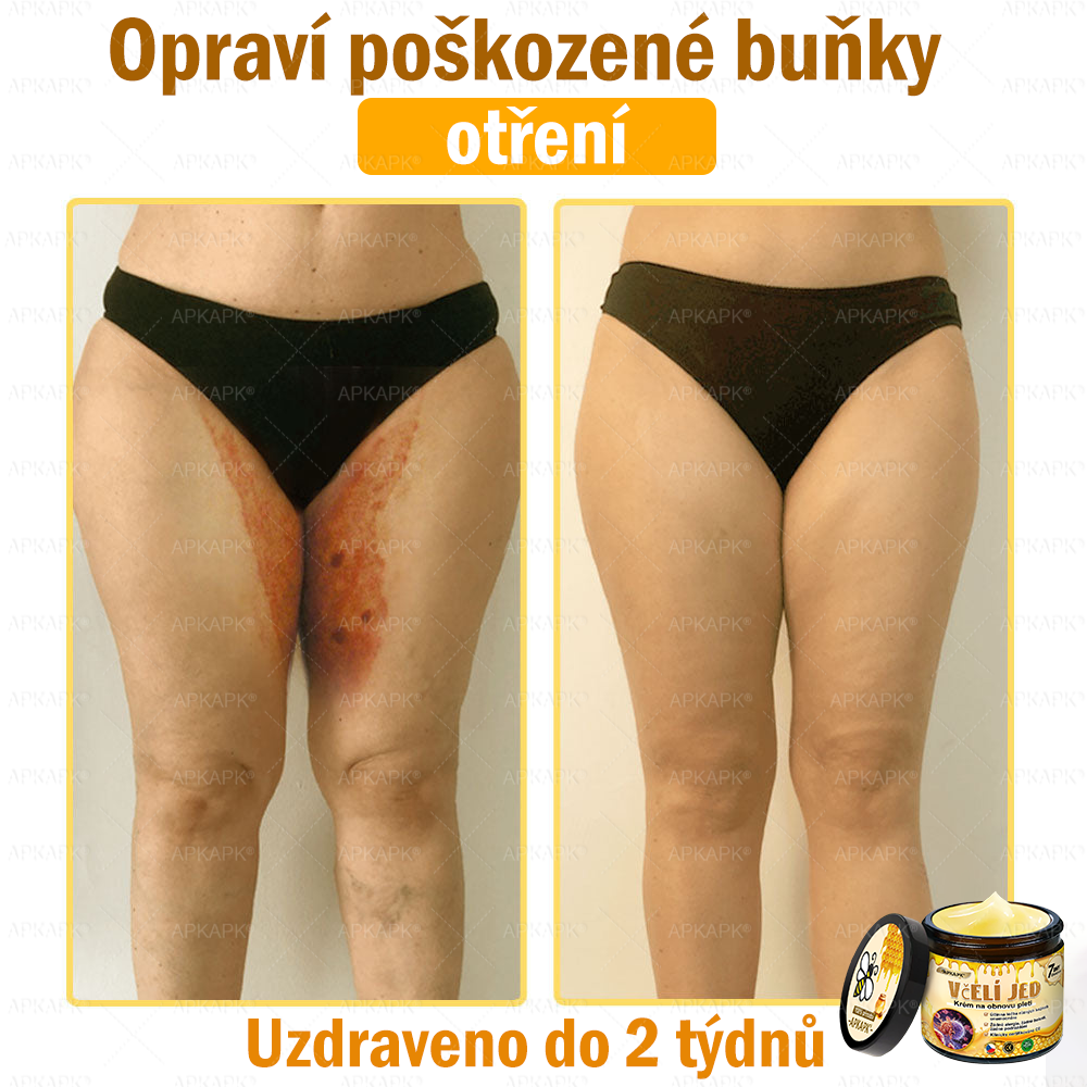🐝Dermatologicky a klinicky testováno👩‍⚕️🐝APKAPK®Bee Venom Krém na obnovení pleti🐝 pomáhá při léčbě kožních problémů, jako jsou: vrásky, jizvy, pigmentové skvrny, strie, akné, psoriáza, ekzém, kožní změny, podráždění, záněty a další kožní problémy.