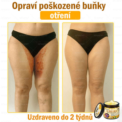 🐝Dermatologicky a klinicky testováno👩‍⚕️🐝APKAPK®Bee Venom Krém na obnovení pleti🐝 pomáhá při léčbě kožních problémů, jako jsou: vrásky, jizvy, pigmentové skvrny, strie, akné, psoriáza, ekzém, kožní změny, podráždění, záněty a další kožní problémy.