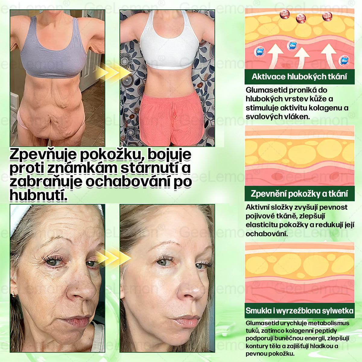 🍃🎁 𝐆𝐞𝑒𝑙𝑒𝐦𝐨𝐧® Glum𝐚𝐬𝐞tide 8 v 1 – Zeštíhlující nano mikrojihlový náplast 🇨🇿 Jen 1× denně ✅ Viditelné změny za 7 dní – na obezitu, kardiovaskulární zdraví, diabetes a kloubní problémy