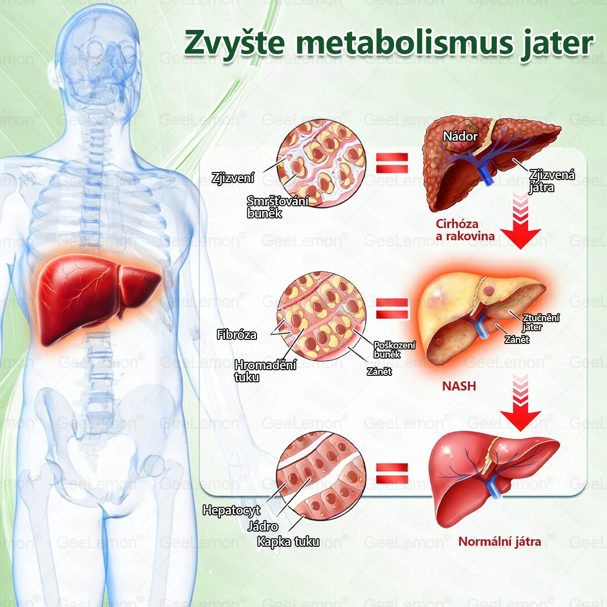 🍃🎁 𝐆𝐞𝑒𝑙𝑒𝐦𝐨𝐧® Glum𝐚𝐬𝐞tide 8 v 1 – Zeštíhlující nano mikrojihlový náplast 🇨🇿 Jen 1× denně ✅ Viditelné změny za 7 dní – na obezitu, kardiovaskulární zdraví, diabetes a kloubní problémy