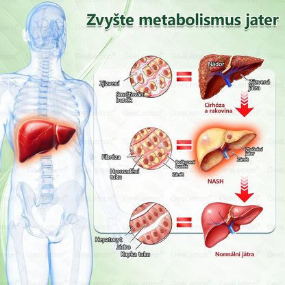 🍃🎁 𝐆𝐞𝑒𝑙𝑒𝐦𝐨𝐧® Glum𝐚𝐬𝐞tide 8 v 1 – Zeštíhlující nano mikrojihlový náplast 🇨🇿 Jen 1× denně ✅ Viditelné změny za 7 dní – na obezitu, kardiovaskulární zdraví, diabetes a kloubní problémy