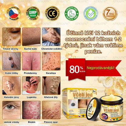 𝖠𝖯𝖪𝖠𝖯𝖪® 🐝 Krém s včelím jedem na obnovu pokožky 🐝 pomáhá při řešení kožních problémů, jako jsou: vrásky, jizvy, pigmentové skvrny, strie, akné, lupénka, ekzém, kožní léze, podráždění, záněty a další kožní potíže.