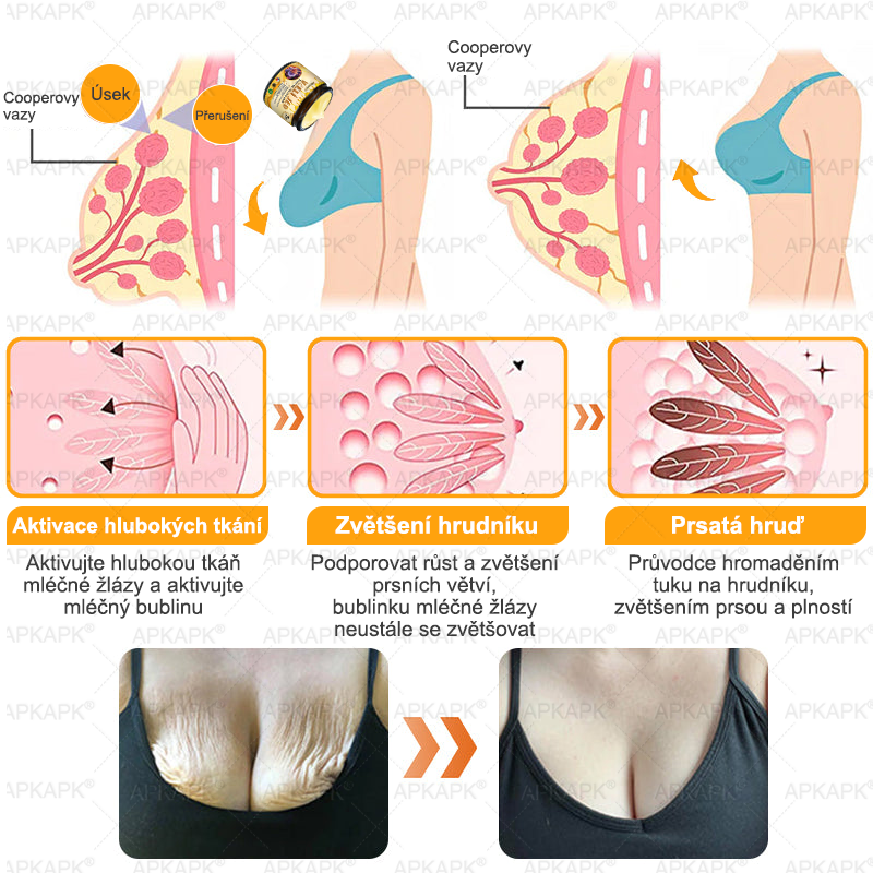 𝖠𝖯𝖪𝖠𝖯𝖪® 🐝 Krém s včelím jedem na obnovu pokožky 🐝 pomáhá při řešení kožních problémů, jako jsou: vrásky, jizvy, pigmentové skvrny, strie, akné, lupénka, ekzém, kožní léze, podráždění, záněty a další kožní potíže.