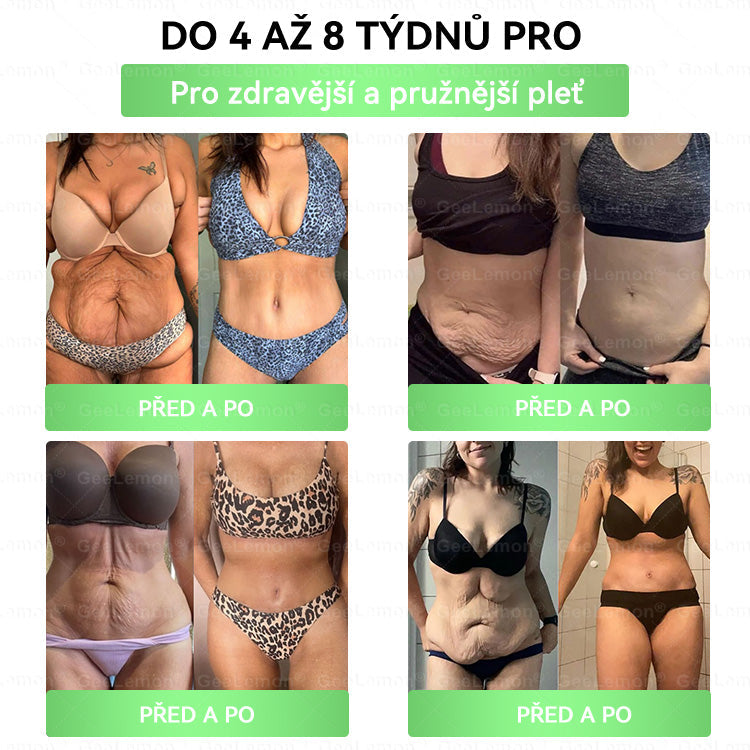 🍃🎁 𝐆𝐞𝑒𝑙𝑒𝐦𝐨𝐧® Glum𝐚𝐬𝐞tide 8 v 1 – Zeštíhlující nano mikrojihlový náplast 🇨🇿 Jen 1× denně ✅ Viditelné změny za 7 dní – na obezitu, kardiovaskulární zdraví, diabetes a kloubní problémy