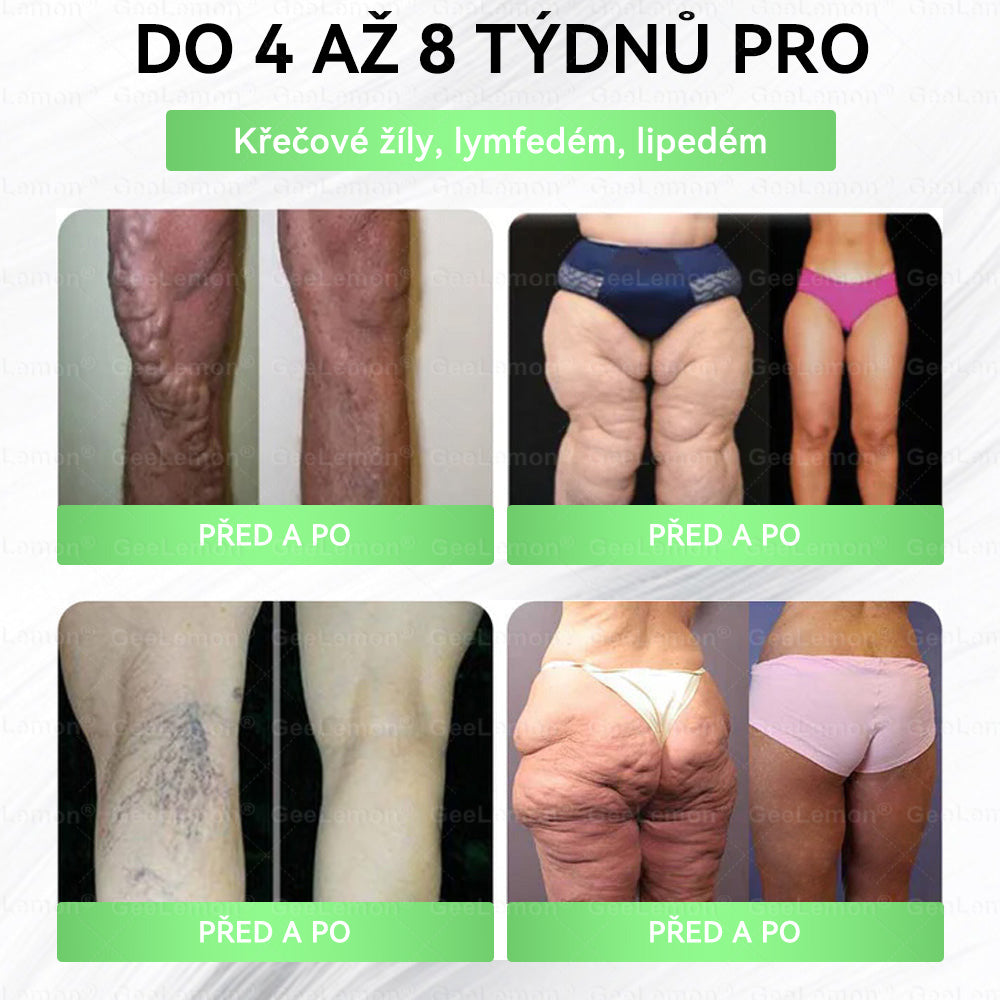 🍃🎁 𝐆𝐞𝑒𝑙𝑒𝐦𝐨𝐧® Glum𝐚𝐬𝐞tide 8 v 1 – Zeštíhlující nano mikrojihlový náplast 🇨🇿 Jen 1× denně ✅ Viditelné změny za 7 dní – na obezitu, kardiovaskulární zdraví, diabetes a kloubní problémy