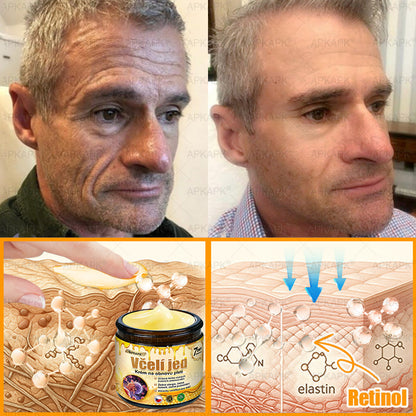 𝖠𝖯𝖪𝖠𝖯𝖪® 🐝 Krém s včelím jedem na obnovu pokožky 🐝 pomáhá při řešení kožních problémů, jako jsou: vrásky, jizvy, pigmentové skvrny, strie, akné, lupénka, ekzém, kožní léze, podráždění, záněty a další kožní potíže.