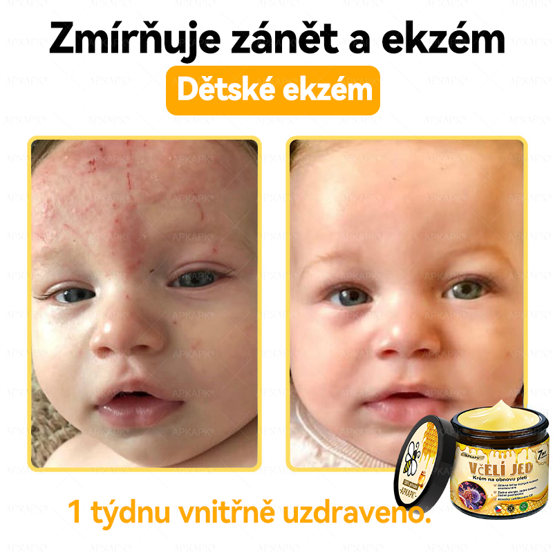 🐝Dermatologicky a klinicky testováno👩‍⚕️🐝APKAPK®Bee Venom Krém na obnovení pleti🐝 pomáhá při léčbě kožních problémů, jako jsou: vrásky, jizvy, pigmentové skvrny, strie, akné, psoriáza, ekzém, kožní změny, podráždění, záněty a další kožní problémy.