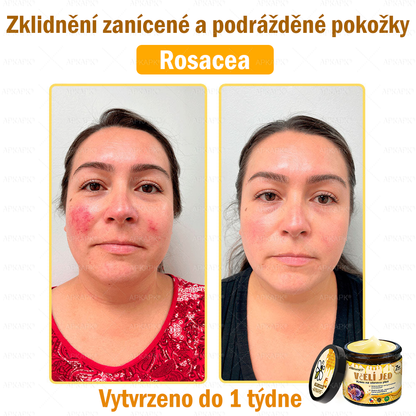 🐝Dermatologicky a klinicky testováno👩‍⚕️🐝APKAPK®Bee Venom Krém na obnovení pleti🐝 pomáhá při léčbě kožních problémů, jako jsou: vrásky, jizvy, pigmentové skvrny, strie, akné, psoriáza, ekzém, kožní změny, podráždění, záněty a další kožní problémy.
