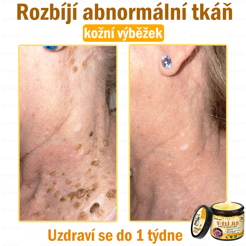 🐝Dermatologicky a klinicky testováno👩‍⚕️🐝APKAPK®Bee Venom Krém na obnovení pleti🐝 pomáhá při léčbě kožních problémů, jako jsou: vrásky, jizvy, pigmentové skvrny, strie, akné, psoriáza, ekzém, kožní změny, podráždění, záněty a další kožní problémy.
