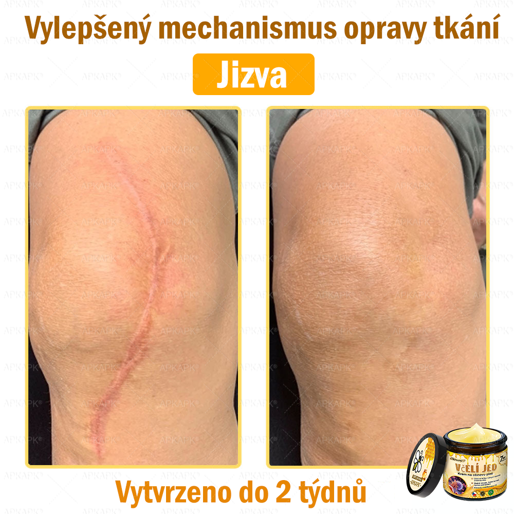 🐝Dermatologicky a klinicky testováno👩‍⚕️🐝APKAPK®Bee Venom Krém na obnovení pleti🐝 pomáhá při léčbě kožních problémů, jako jsou: vrásky, jizvy, pigmentové skvrny, strie, akné, psoriáza, ekzém, kožní změny, podráždění, záněty a další kožní problémy.