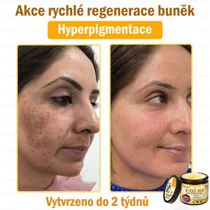 🐝Dermatologicky a klinicky testováno👩‍⚕️🐝APKAPK®Bee Venom Krém na obnovení pleti🐝 pomáhá při léčbě kožních problémů, jako jsou: vrásky, jizvy, pigmentové skvrny, strie, akné, psoriáza, ekzém, kožní změny, podráždění, záněty a další kožní problémy.
